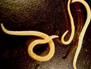 Worms