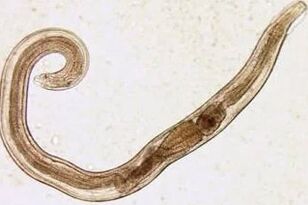 Parasites of a man cut