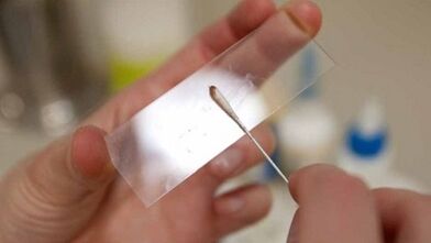 Calais analysis for parasite identification