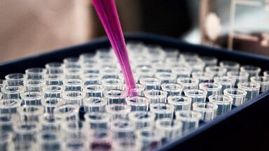 How to take tests to detect parasites in the body